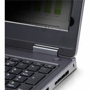 StarTech 14-Inch Laptop Privacy Screen Filter, 16:10 Aspect Ratio, Blue Light Reduction, Flip-Over Design