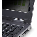StarTech 15.6-Inch Laptop Privacy Screen Filter - 16:9, Flip-Up, Blue Light Reduction